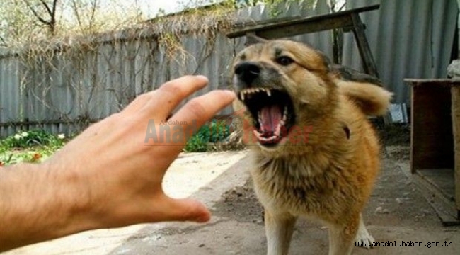KÖPEKLER ÖĞRETMENİ AĞIR YARALADI!