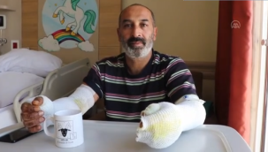 Tüp Kaçağı sonucu ağır yaralandı!