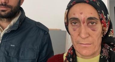 BU KADINI, KADIN MUHTARIN EŞİ CAMİ İMAMI MI BU HALE SOKTU!